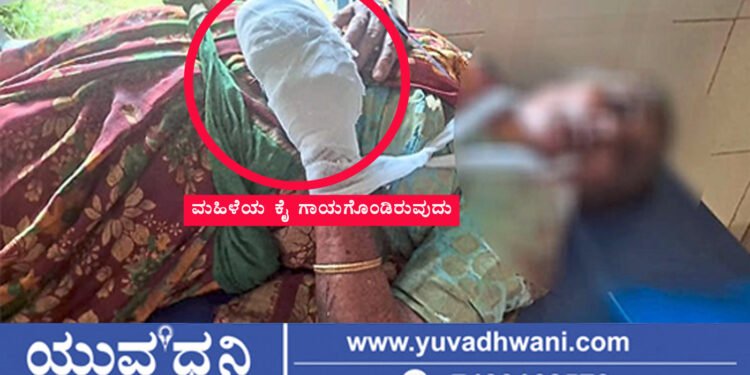 ಶಿಕಾರಿಗೆ ಇಟ್ಟಿದ್ದ ಕಚ್ಚಾ ಬಾಂಬ್ ಸಿಡಿದು ಮಹಿಳೆಯ 5 ಬೆರಳು ಕಟ್?, ಘಟನೆ ನಡೆದಿದ್ದೇಲಿ?