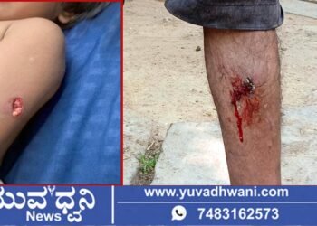 ಸೋಮಿನಕೊಪ್ಪದಲ್ಲಿ ಬಾಲಕಿ ಸೇರಿದಂತೆ ಇಬ್ಬರ ಮೇಲೆ ಬೀದಿ ನಾಯಿ ದಾಳಿ!