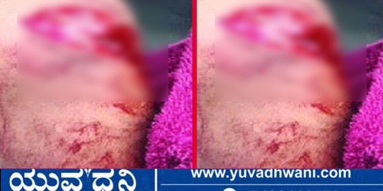 ಅರಹತೊಳಲು ಗ್ರಾಮದಲ್ಲಿ ಮುಸಿಯಾ ದಾಳಿ, ಬಾಲಕ ಅಸ್ವಸ್ಥ!